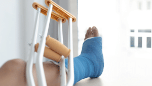 A person’s leg in a blue cast rests on a surface next to a pair of crutches, with natural light coming through a window in the background.
