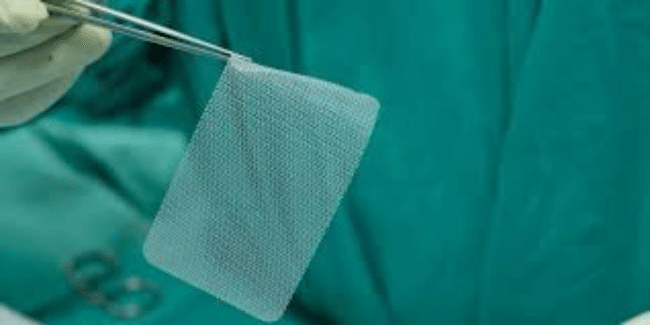 A gloved hand uses forceps to hold a rectangular surgical mesh against a green medical drape background.