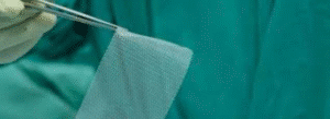 A gloved hand uses forceps to hold a rectangular piece of surgical mesh against a green surgical drape background.