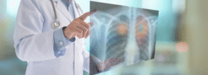 A doctor in a white coat points to a chest X-ray image displaying lungs, with some highlighted areas suggesting a medical focus.