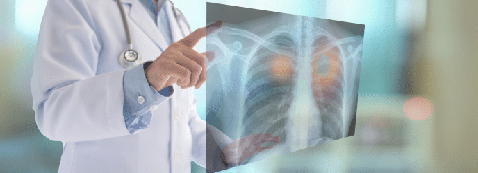 A doctor in a white coat points to a chest X-ray image displaying lungs, with some highlighted areas suggesting a medical focus.